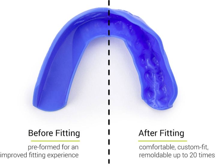 Protecția dinților Sisu 3D Royal Blue